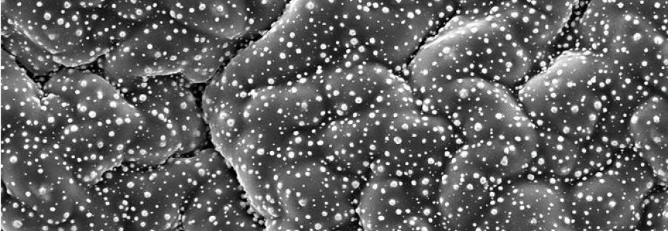 Metal polymer nanocomposites