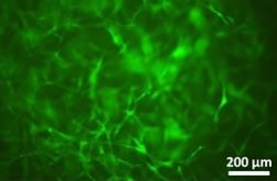 Viability image of live human stem cells (green) seeded on a nano-structured scaffold comprised of both natural and synthetic polymers.